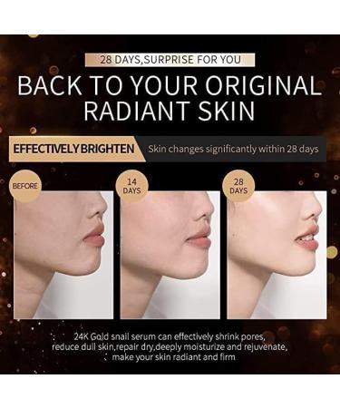 |Most Gifted| 24k Gold Snail Serum - 4PCS Say Goodbye to Wrinkles Without Expensive with 24K Gold Collagen Booster Serum - 17ml/0.59fl.oz - Buy Online on GoSupps.com