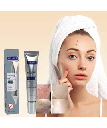 Acne Spot Repair Cream | Salicylic Acid & Aloe Vera Gel | Oil-Free Acne Care Moisturizer | Fast Absorption | 0.7 Floz - Buy Online on GoSupps.com