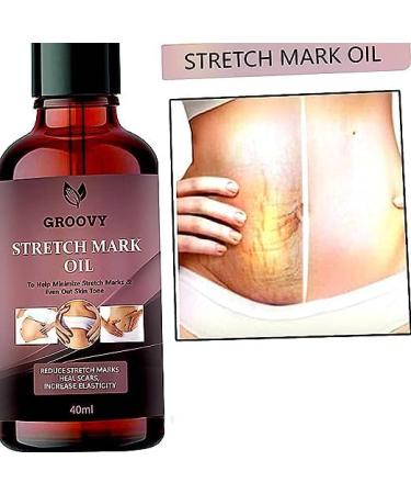 Stretch Mark Skin Oil - Reduce Scars Boost Elasticity | 40 ML - Best International Shipping - Buy Online on GoSupps.com