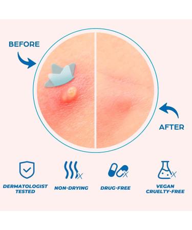 Buy Colorful Hydrocolloid Pimple Patches for Face | Star Acne Stickers in Small Medium Large | Salicylic Blemish Treatment - Buy Online on GoSupps.com