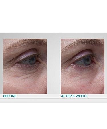 Dr. Denese SkinScience Essential Lipid Anti Aging Power Infusion Dry Oil - 97% Organic & 100% Natural Skincare with Amaranth & Resveratrol - Paraben-Free Cruelty-Free - 2oz - Buy Online on GoSupps.com