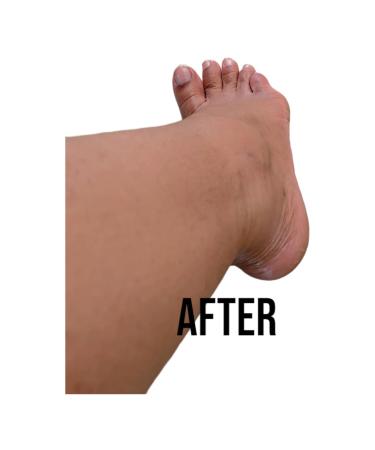 Citrus Body Butter 4 oz - Nourishing Moisturizer for Soft Hydrated Skin | Shop Internationally - Buy Online on GoSupps.com