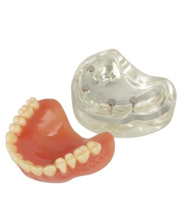 Buy Teach Study Adult Standard Typodont Teeth Model - Ideal for Dental Education & Demonstration | Fast International Shipping - Buy Online on GoSupps.com