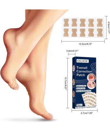 200 Pieces Ingrown Toenails Stickers Toenail Correction Patch Glue-Free Ingrown Curved Toenail Lifter Foot Care Treatment Pedicure Tool (A) - Buy Online on GoSupps.com