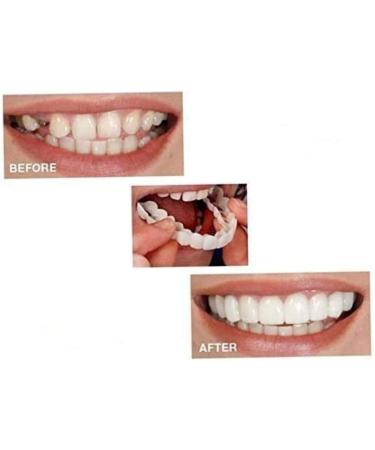 Buy Cucufa Instant Veneers - Cosmetic Teeth Covers for Perfect Smile | 2 Pairs of Upper & Lower Temporary Teeth - Buy Online on GoSupps.com