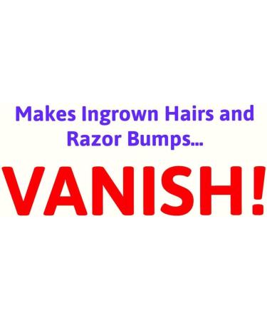 V22 MAX Double Strength Ingrown Hair Treatment Cream - Paraben and Cruelty Free - 50ml - Buy Online on GoSupps.com