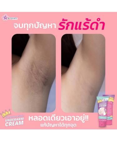 Gangnam Underarm Cream 30g - Light Texture Gentle Moisturizer | Buy 3 + Free Beauty Gifts at Beautygoodshop - Buy Online on GoSupps.com