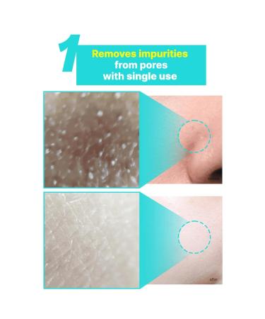 Elishacoy | TETRAFORCE Cica Peeling Toner Pads Gentle Exfoliating & Calming Toner with Cica Daily Skin Smoothing & Hydration Vegan & Dermatologist Tested 150 mL - Buy Online on GoSupps.com