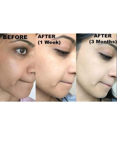 Premium Lightening Soap with Glutathione, Arbutin & Kojic Acid - 65g Bar | Rejuvenates & Clears Skin - Buy Online on GoSupps.com