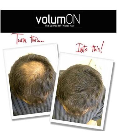 Volumon Professional Hair Building Fibres- Hair Loss Concealer- COTTON- 12g- Get Upto 30 Uses- CHOOSE FROM 8 HAIR SHADES COLOURS (Black) - Buy Online on GoSupps.com