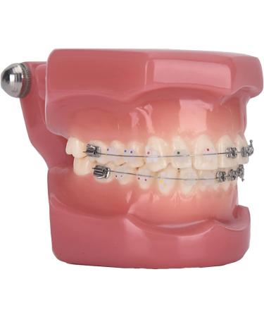 Dytah 1:1 Orthodontic Treatment Teeth Model - Patient Communication & Teaching Tool with Metal & Ceramic Brackets for Adults - Buy Online on GoSupps.com