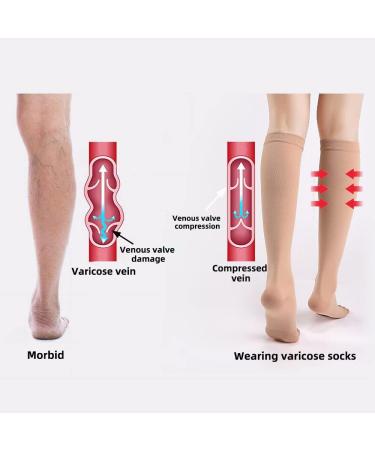 2 Pair XXL Beige Compression Socks for Plantar Fasciitis & Arch Support - Buy Online on GoSupps.com