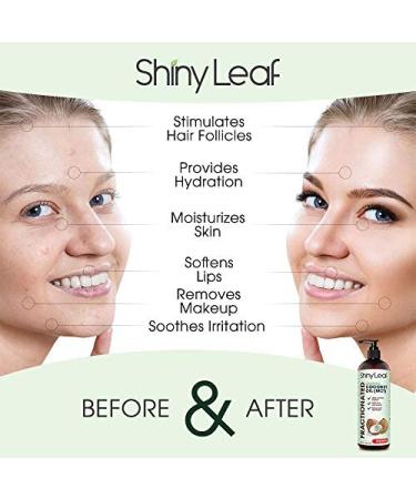 Fractionated Coconut Oil 16 fl. oz. - 100% Pure Natural Body & Massage Oil - Non-Greasy Skin & Hair Moisturizer by Shiny Leaf - Buy Online on GoSupps.com