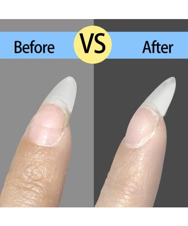 FZANEST Rubber Base Gel & Diamond Top Coat Set | Long Lasting Gel Polish Kit | Ultra Shine No Wipe Finish | LED Lamp Required - Buy Online on GoSupps.com