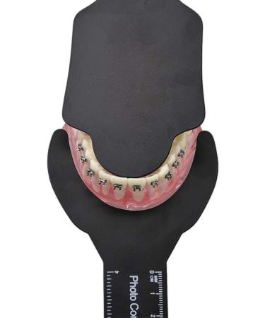 6Pcs Dental Photo Contrast Black Background Board - Autoclavable Orthodontic Cheek Retractors - Buy Online on GoSupps.com