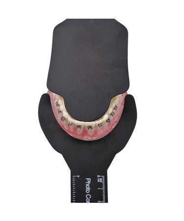 Buy Angzhili 6 Pcs Dental Contraster Kit - Intraoral Photographic Black Background Board for Superior Dental Imaging | Best Price & Fast International Shipping - Buy Online on GoSupps.com