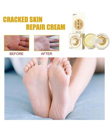Natural Anti-Cracking Frost Repair Cream for Hands & Feet | Cracked Skin Relief & Regeneration | Winter Skin Care - Buy Online on GoSupps.com
