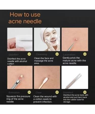 Danbao DANBAO Blackhead remover Acne acne extractor tool whitehead remover beautician supplies facial skin care tool The best acne removal kit-treatment of blemishes whiteheads clear nose skin (5PCS) 17.5*3.5*2 - Buy Online on GoSupps.com