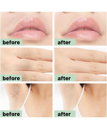 Beaupretty Body Hair Removal Wax Strips Kit - Sensitive Skin Brazilian Wax Strips for Face & Body | Hair Removal Solution - Buy Online on GoSupps.com