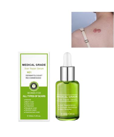 Goopgen Advanced Scar Repair Serum Goopgen Medical Grade Scar Repair Serum Proregen Medical Scar Removal Spray Scar Remove Medical Grade Scar Spray for All Types of Scars (1PCS)