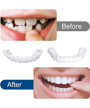 Buy UQLPXZ 2 Pairs Fake Braces Veneers - Instant Cosmetic Dentures for Bad Teeth | International Shipping Available - Buy Online on GoSupps.com