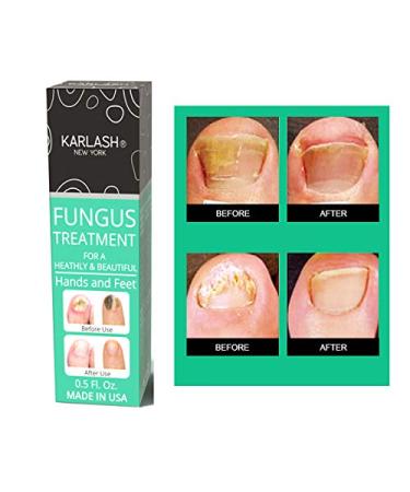 Karlash Extra Strong Nail Fungus Treatment Kit - Made in USA - 0.5oz - For Nails and Toes - Buy Online on GoSupps.com