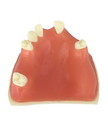 Samnuerly Education Model Toy Teeth Upper Jaw Teeth Model Upper Jaw Sinus Lift Implants Restoration Model 40mm