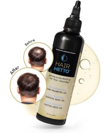 HAIRMETTO Topical Hair Oil Hair Loss Product Formulated with Saw Palmetto Oil and Pumpkin Seed Oil for Hair Growth Soothes Dry Scalp Strengthens Roots Lavender Scent 118 mL Bottle - Buy Online on GoSupps.com