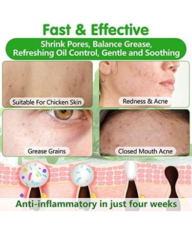 Best Acne Treatment Spray with Organic Tea Tree Oil - Clear Acne on Face Body & Back | 4.3 OZ Skin Care Solution - Buy Online on GoSupps.com