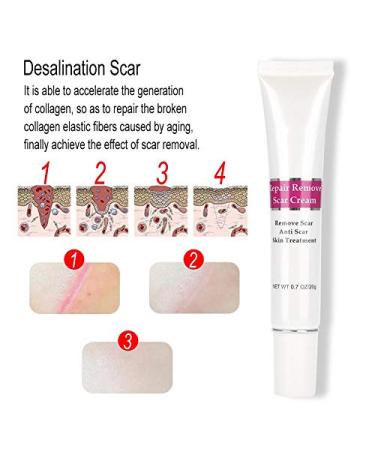 Scar Removal Cream | Anti-Scar Gel for Old Scars, Stretch Marks & Burned Skin Repair - Buy Online on GoSupps.com