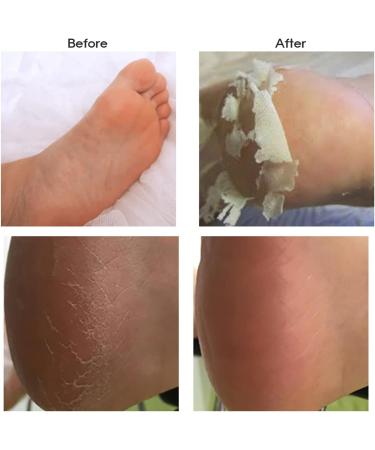 Pretty Skin Foot Peeling Mask - Exfoliates Repairs Moisturises for Dry Rough Feet - 16ml - 1 Pair - Buy Online on GoSupps.com