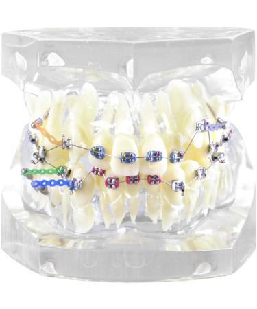 Dytah Dental Painting Model - Orthodontic Treatment with Brackets & Buccal Tube for Malocclusion Study & Lessons - Buy Online on GoSupps.com