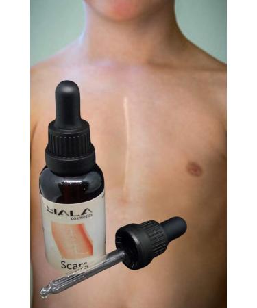Special Oil| Removal of Scars Blemishes| Accelerate Healing Process| Repairing Damaged Skin| Rich Vitamin E|Antioxidant|Hydration|100% Ingredient Natural No Animals Testing Cruelty Free - Buy Online on GoSupps.com