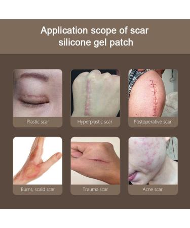 Silicone Scar Sheets | Medical Grade Clear Gel Strips for Surgical Scars | C-Section, Breast, Burn, Keloid, Acne | 6cm x 15cm | Scar Tape for Effective Scar Removal - Buy Online on GoSupps.com