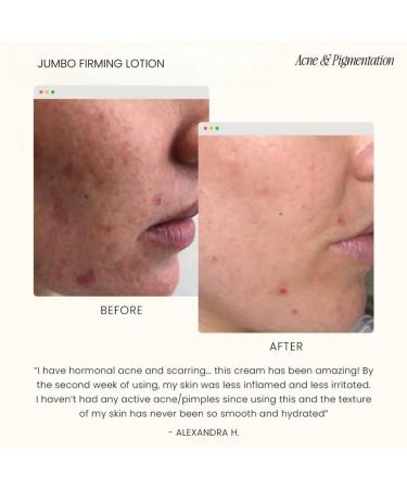Firming Body Lotion - Hydrating Skin Moisturizer for Smoother Toned and Nourished Skin Lightweight Daily Cream for All Skin Types - (13.5 fl.oz) - Fragrance Free - Buy Online on GoSupps.com