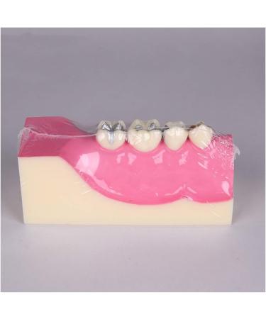 Fhuili Teeth Model for Training | Realistic Oral Tooth Demonstration & Recovery Model for Study | International Shipping - Buy Online on GoSupps.com