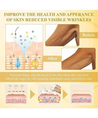 Kanoauo Apisderm Botoxbee Advanced MultiAction Festing Cream Bee strengthening cream advanced fortressing and wrinkle reduction cream for all skin types 100 g - Buy Online on GoSupps.com