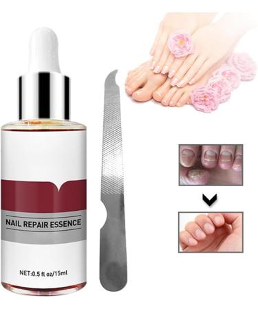 1PC Nail Repairs Nail Treatment Nail Renewal Solution Toenails & Fingernails Nail Repairs Essential Oil Protects From Discoloration Brittle And Cracked Nail(12ML) - Buy Online on GoSupps.com