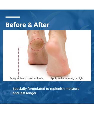 Urea 40% Foot Cream Cracked Heel Repair Cream For Feet and Hands Callus Remover For Dry And Hard Skin Urea Cream for Hand Foot Body Care 50g - Buy Online on GoSupps.com