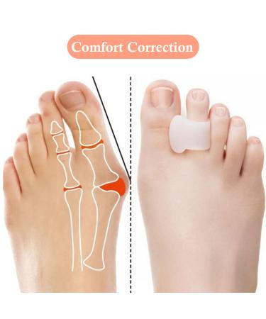 Bale Toe Correction for Men & Women - Hallux Valgus Protection 2 Pairs - Optimize Comfort & Alignment - Buy Online on GoSupps.com