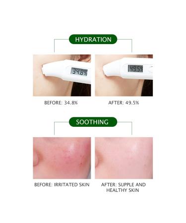 VENZEN Jojoba Oil 100ml - Moisturizing & Nourishing Simmondsia Chinensis for Soothing Skin | International Shipping Available - Buy Online on GoSupps.com