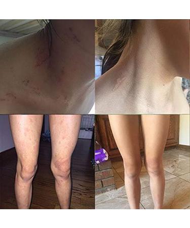 Buy Emulsion 2 - 15ML | Premium International Shipping | Best eCommerce Deals - Buy Online on GoSupps.com