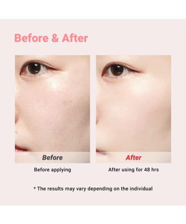 Real Barrier Cicarelief Cream Recovering Face Moisturizer for Damaged Skin Calming with Cica Panthenol Madecassoside Dressing Care Sunburn Relief Irritation Tested 1.05 Oz. 30g - Buy Online on GoSupps.com
