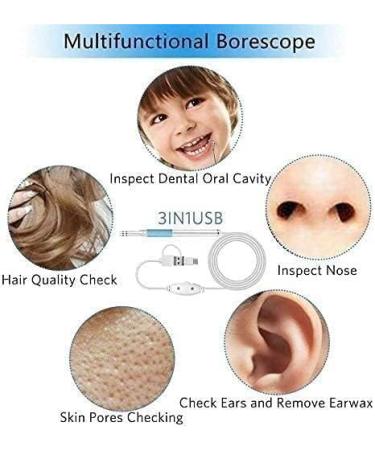 JYYBN Ear Wax Removal Tool with Camera - 6 LED Lights, Ear Scope for Adults, Children, Pets - Yellow - Buy Online on GoSupps.com