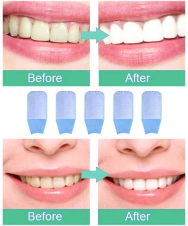 Teeth Cleaning Wipes - Whitening & Hygiene Care Tool - 50pcs Finger Toothbrushes for Easy Oral Care - Buy Online on GoSupps.com