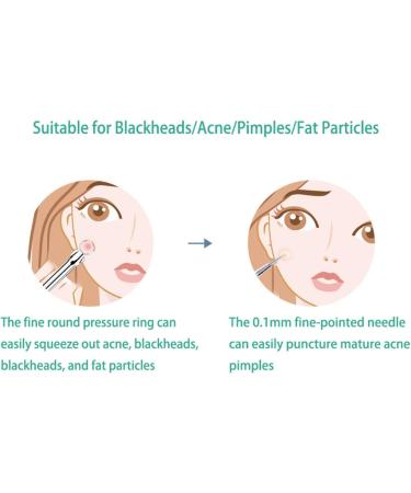 LHYILSWQ 2Pc Blackhead Remover Tool Set Stainless Pimples Comedone Extractor Removal Acne Removal Kit Silver - Buy Online on GoSupps.com