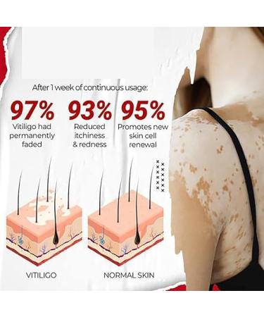 (Quick Effect) 1/2/4pcs & 30ml (4pcs) - Buy Online on GoSupps.com
