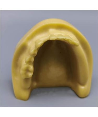 Fhuili Teeth Implant Model - Realistic Dental Simulation for Practice & Education | Lower Half Teeth Demonstration Model - Buy Online on GoSupps.com