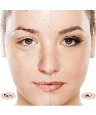 Rosehip Facial Cleanser 125g | Natural Handmade Soap for Face and Body | Gentle Exfoliating Scrub | Hydration and Scar Care | Soft and Glowing Skin - Buy Online on GoSupps.com