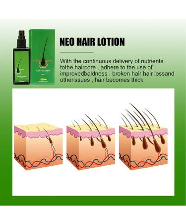 Hair Growth Serum for Men & Women - 120ml Hair Regrowth Lotion Anti Hair Loss Promotes Thicker Stronger Hair & Beard - 100% Natural Herbs - Buy Online on GoSupps.com